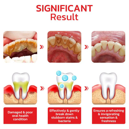 🦷 SP4 Ultra Whitening Probiotic Toothpaste – Fresh & Clean Oral Care